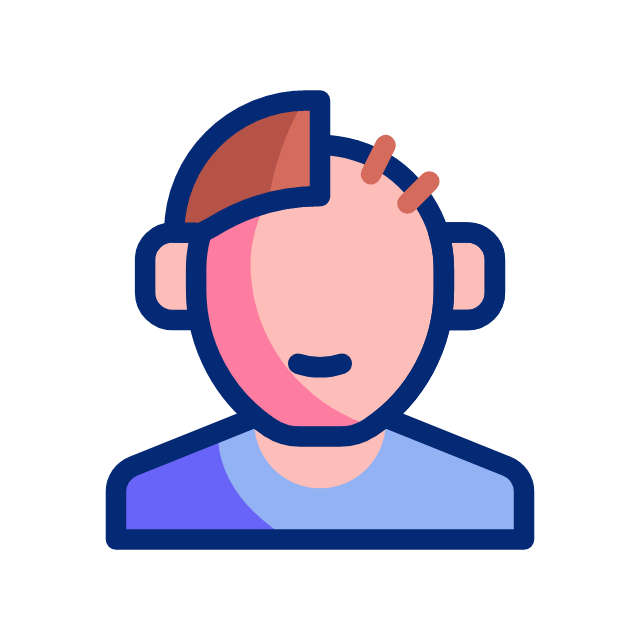 illustration of a man experiencing early-stage male pattern baldness and partial hair loss, highlighting signs that indicate the need for RootRestore’s clinically proven hair regrowth program utilizing dutasteride, finasteride, and topical minoxidil for effective, long-lasting hair restoration.